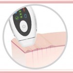 tria age defying laser review 